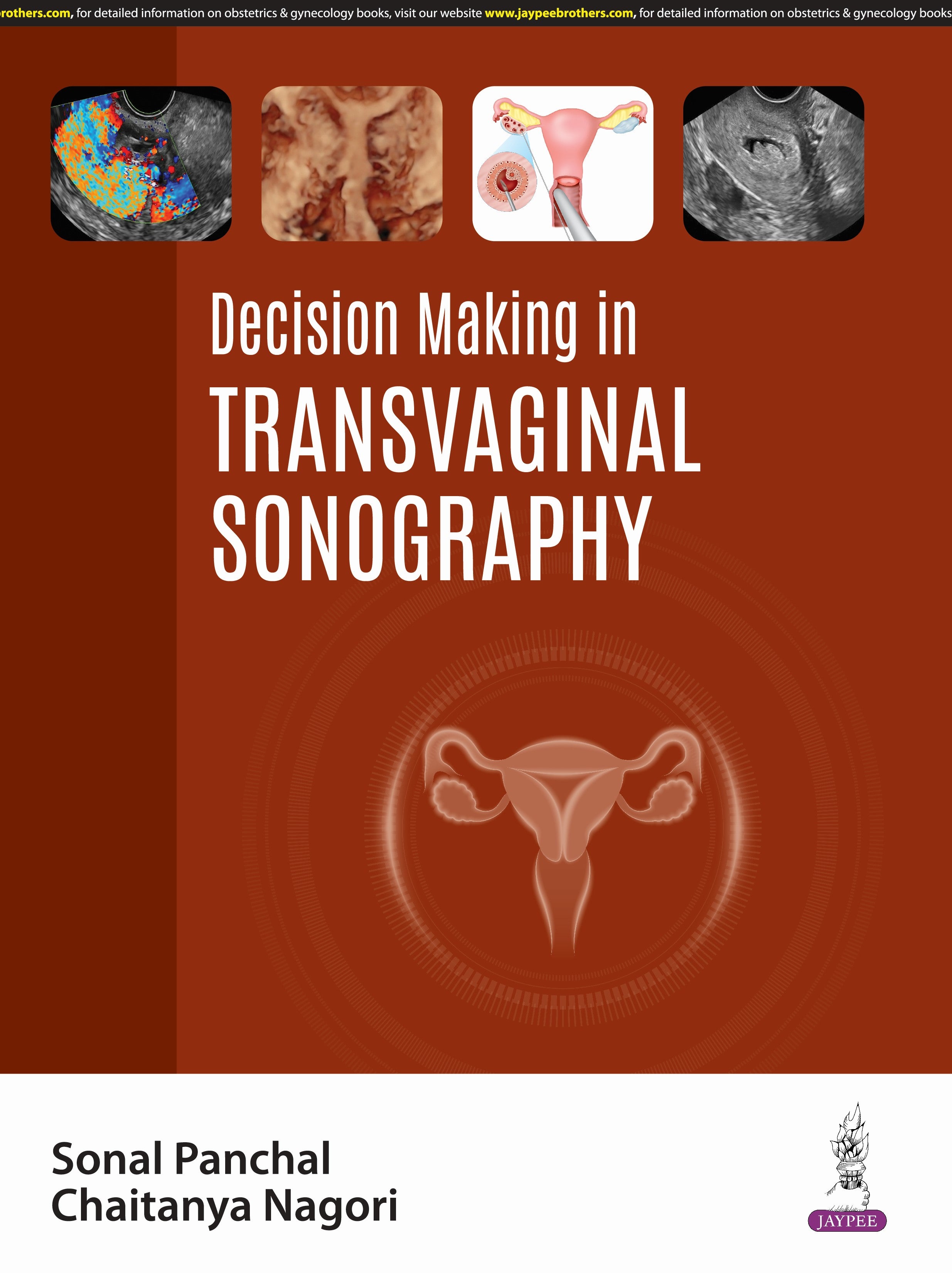 DECISION MAKING IN TRANSVAGINAL SONOGRAPHY