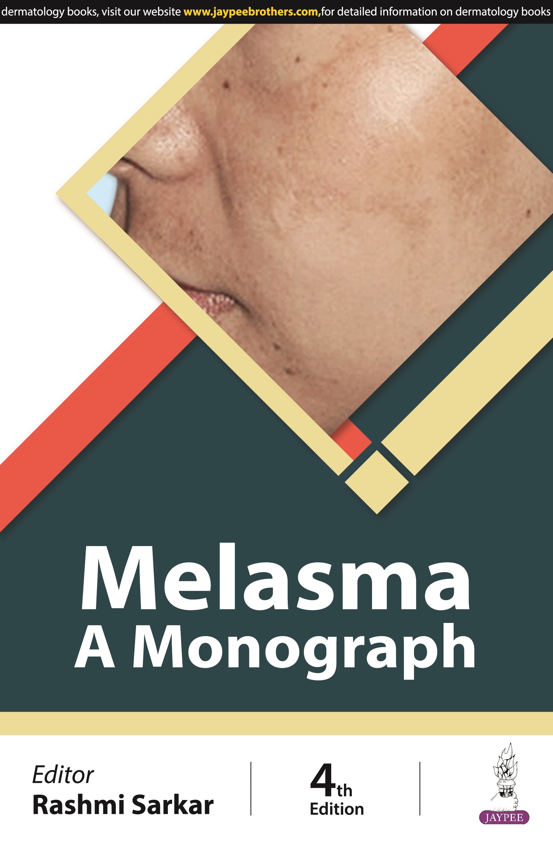 MELASMA: A MONOGRAPH