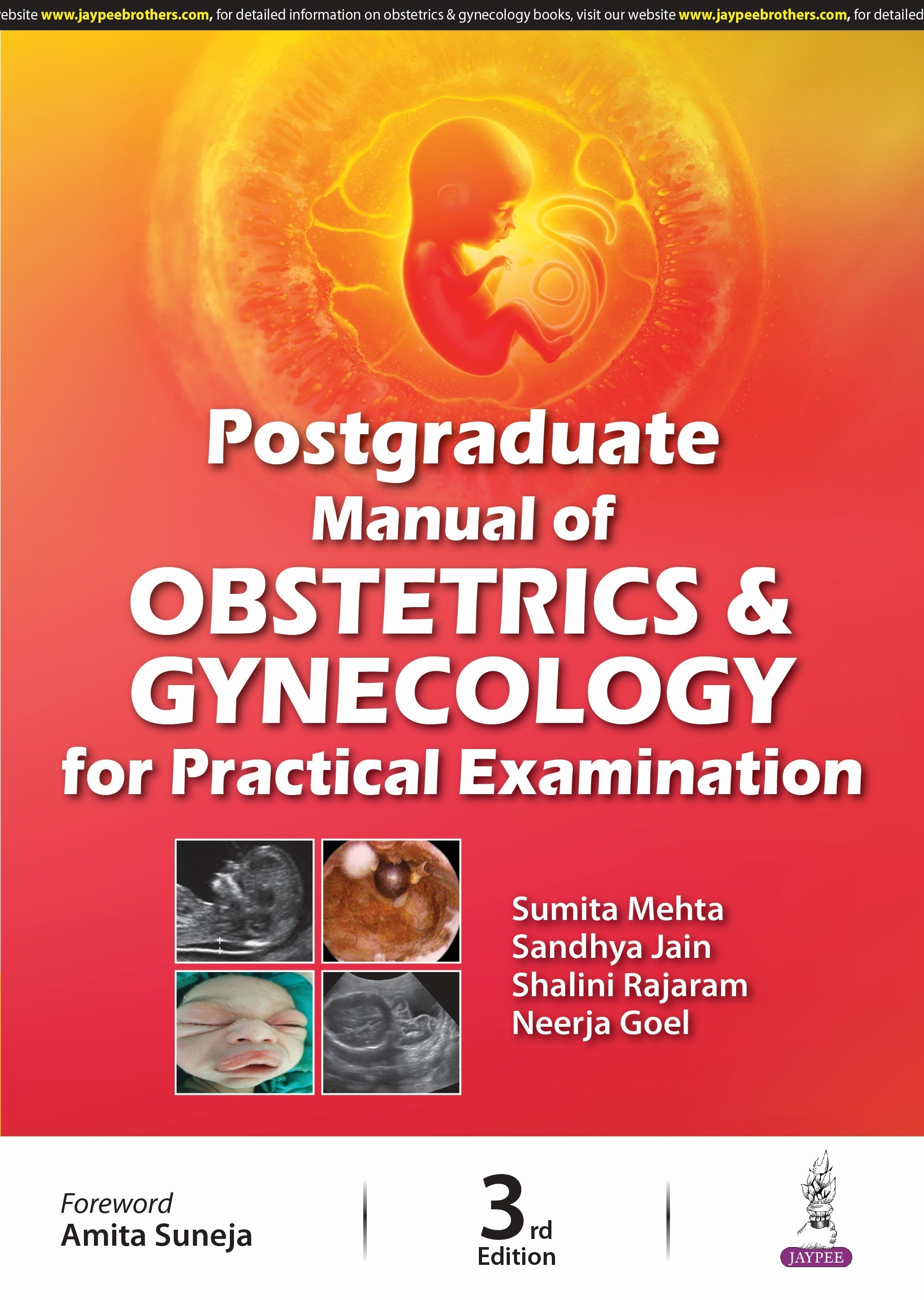 POSTGRADUATE MANUAL OF OBSTETRICS & GYNECOLOGY FOR PRACTICAL EXAMINATION
