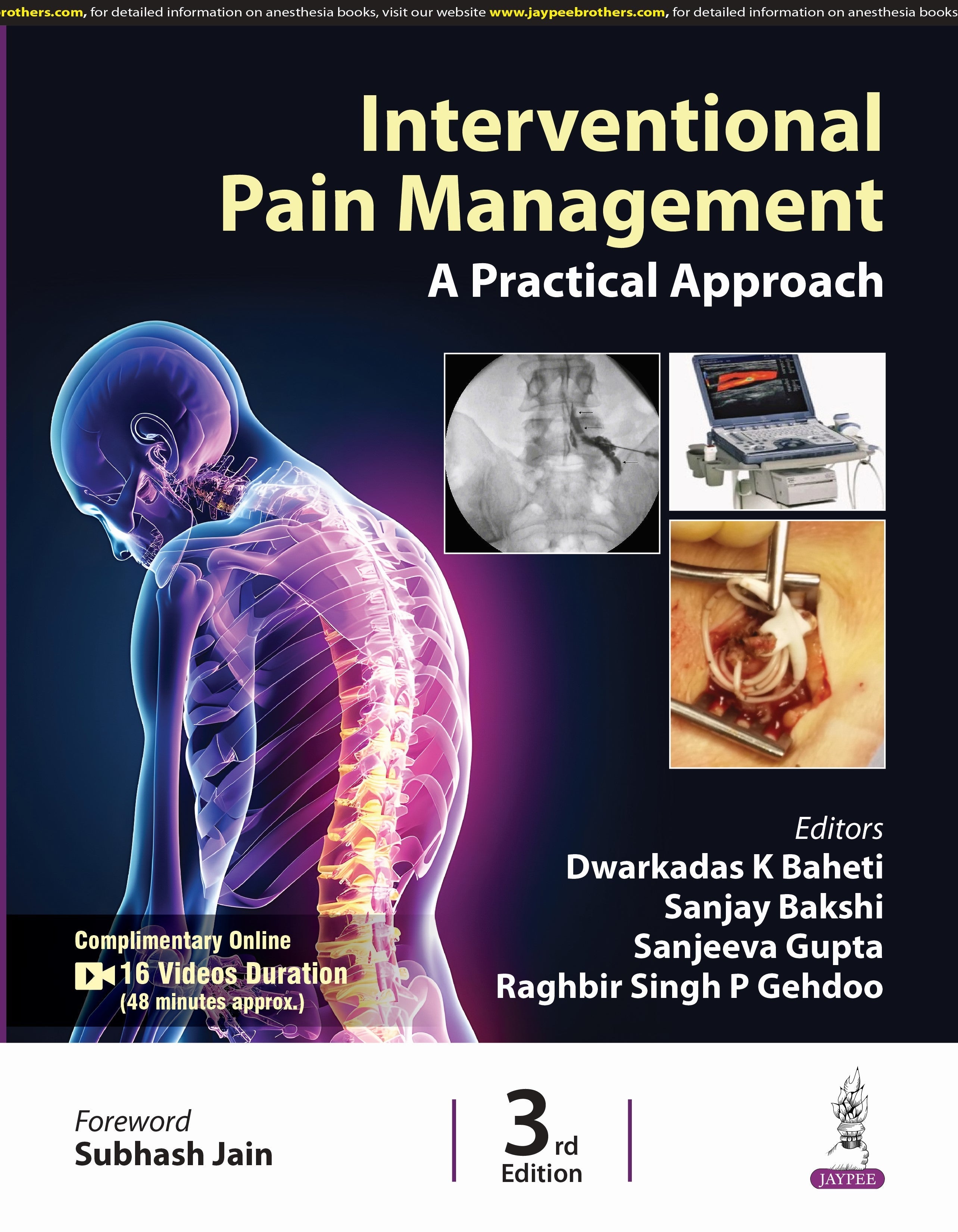 INTERVENTIONAL PAIN MANAGEMENT A PRACTICAL APPROACH