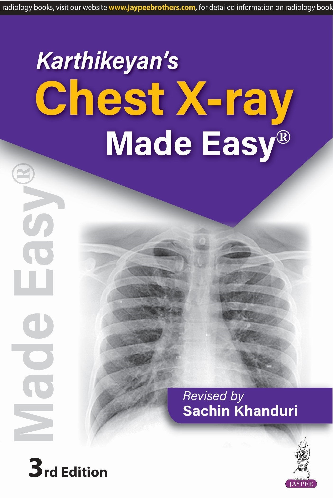 KARTHIKEYAN'S CHEST X-RAY MADE EASY