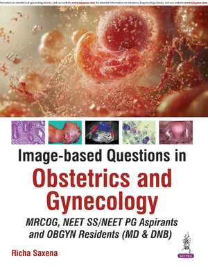 IMAGE-BASED QUESTIONS IN OBSTETRICS AND GYNECOLOGY