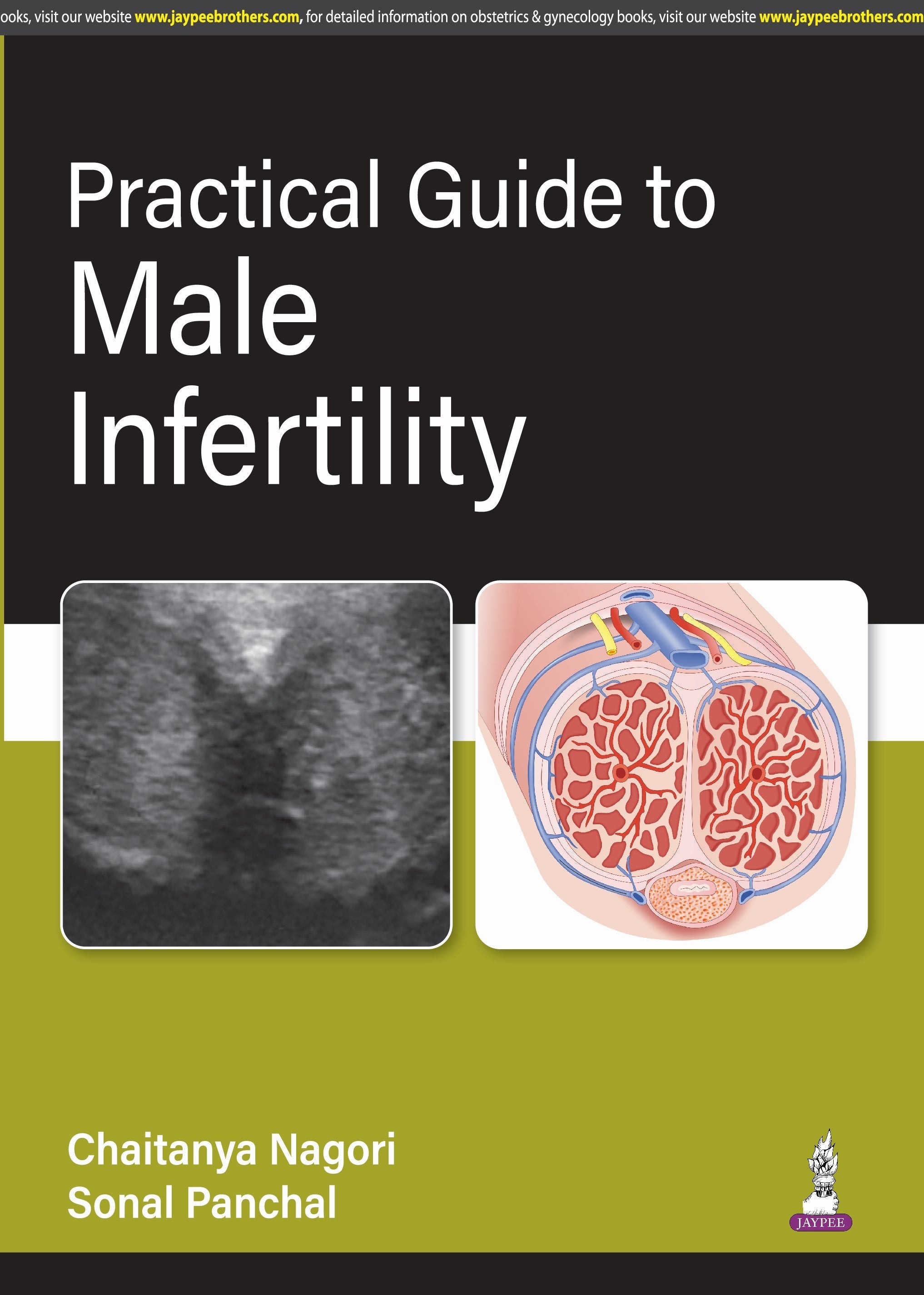PRACTICAL GUIDE TO MALE INFERTILITY