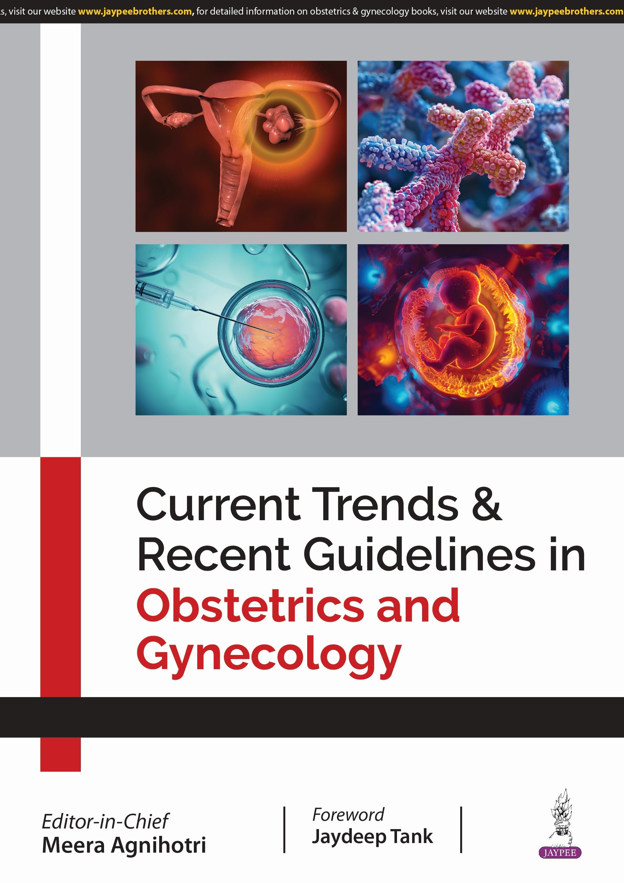 CURRENT TRENDS & RECENT GUIDELINES IN OBSTETRICS AND GYNECOLOGY