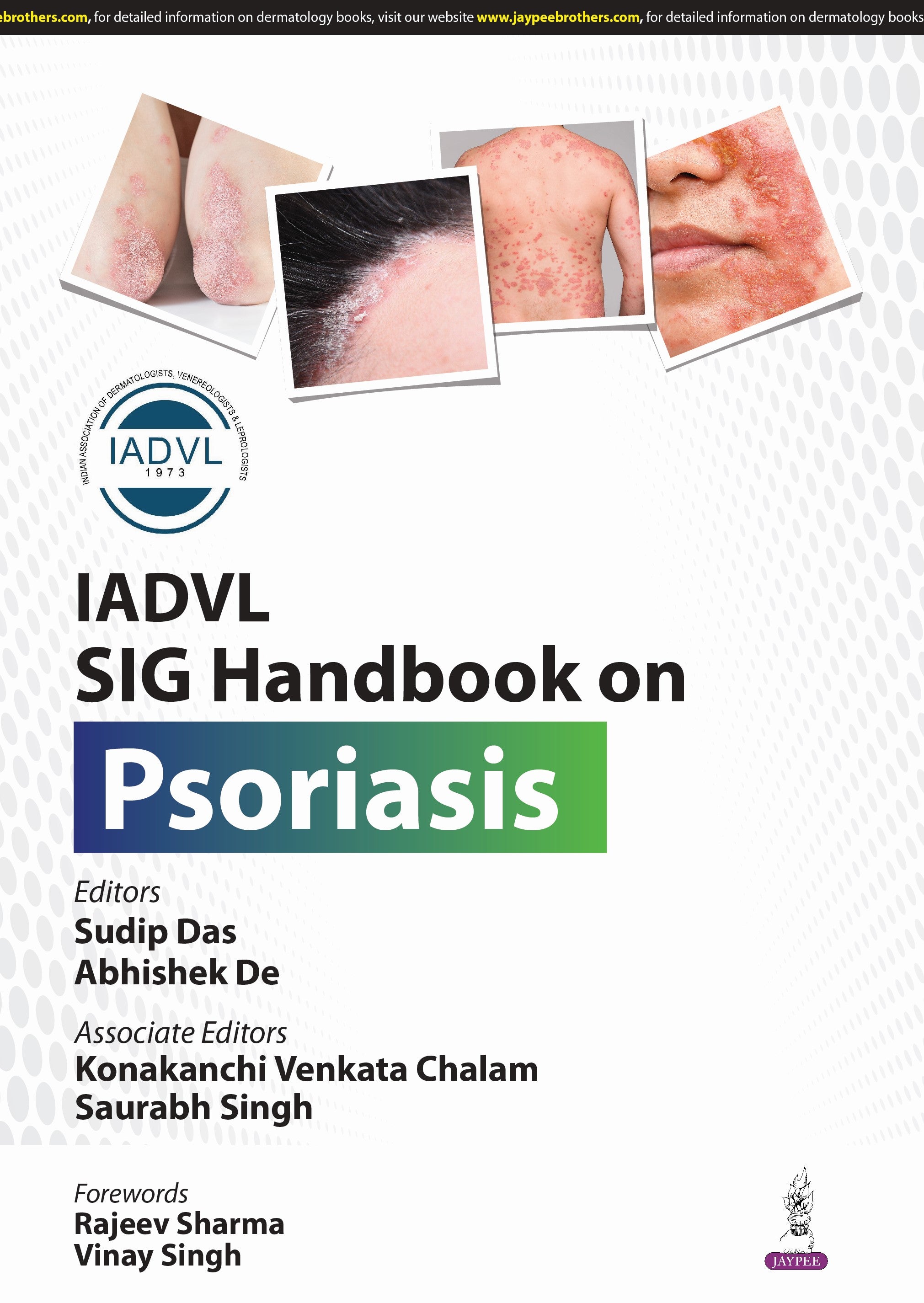IADVL SIG HANDBOOK ON PSORIASIS
