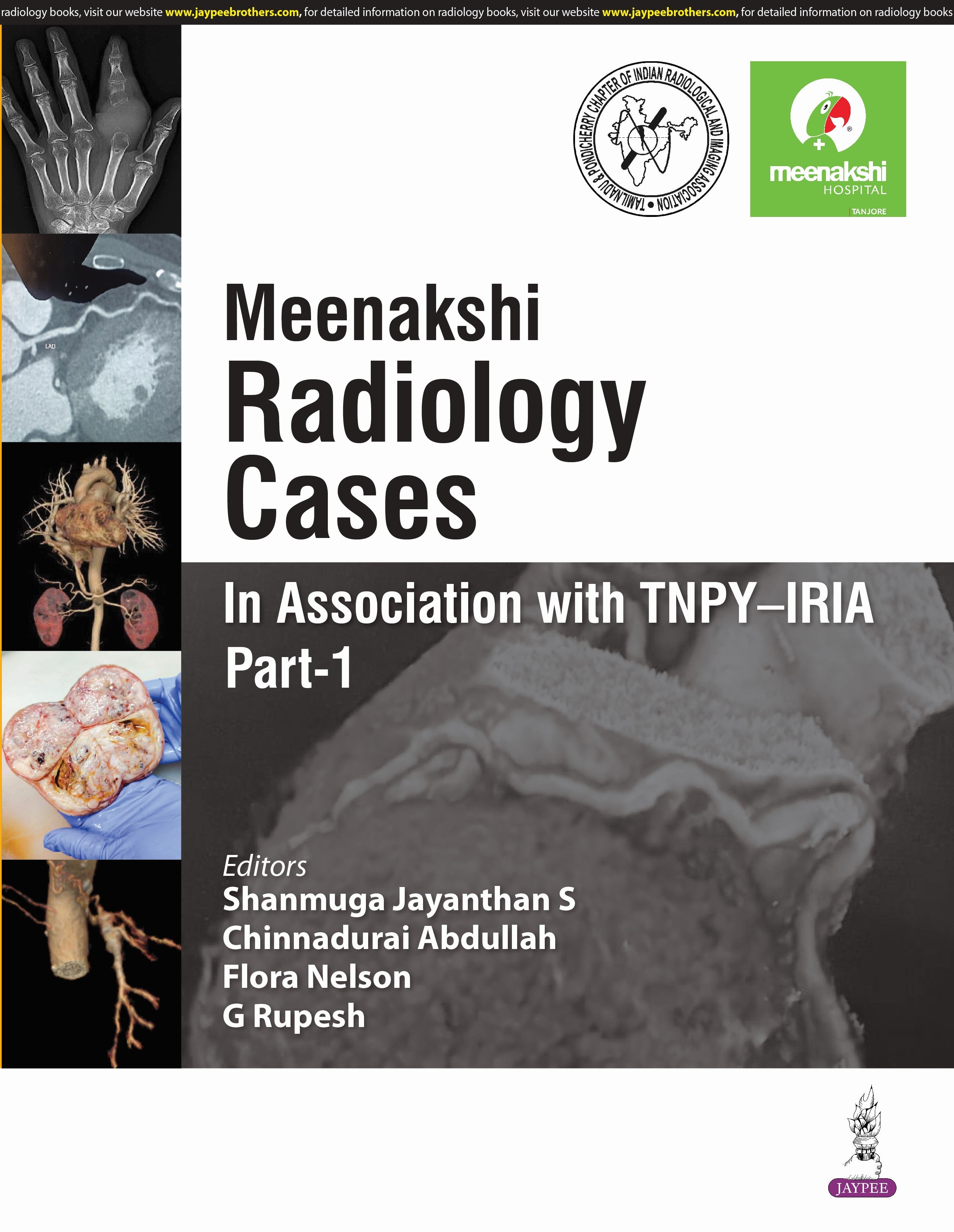MEENAKSHI RADIOLOGY CASES : IN ASSOCIATION WITH TNPY-IRIA PART-1