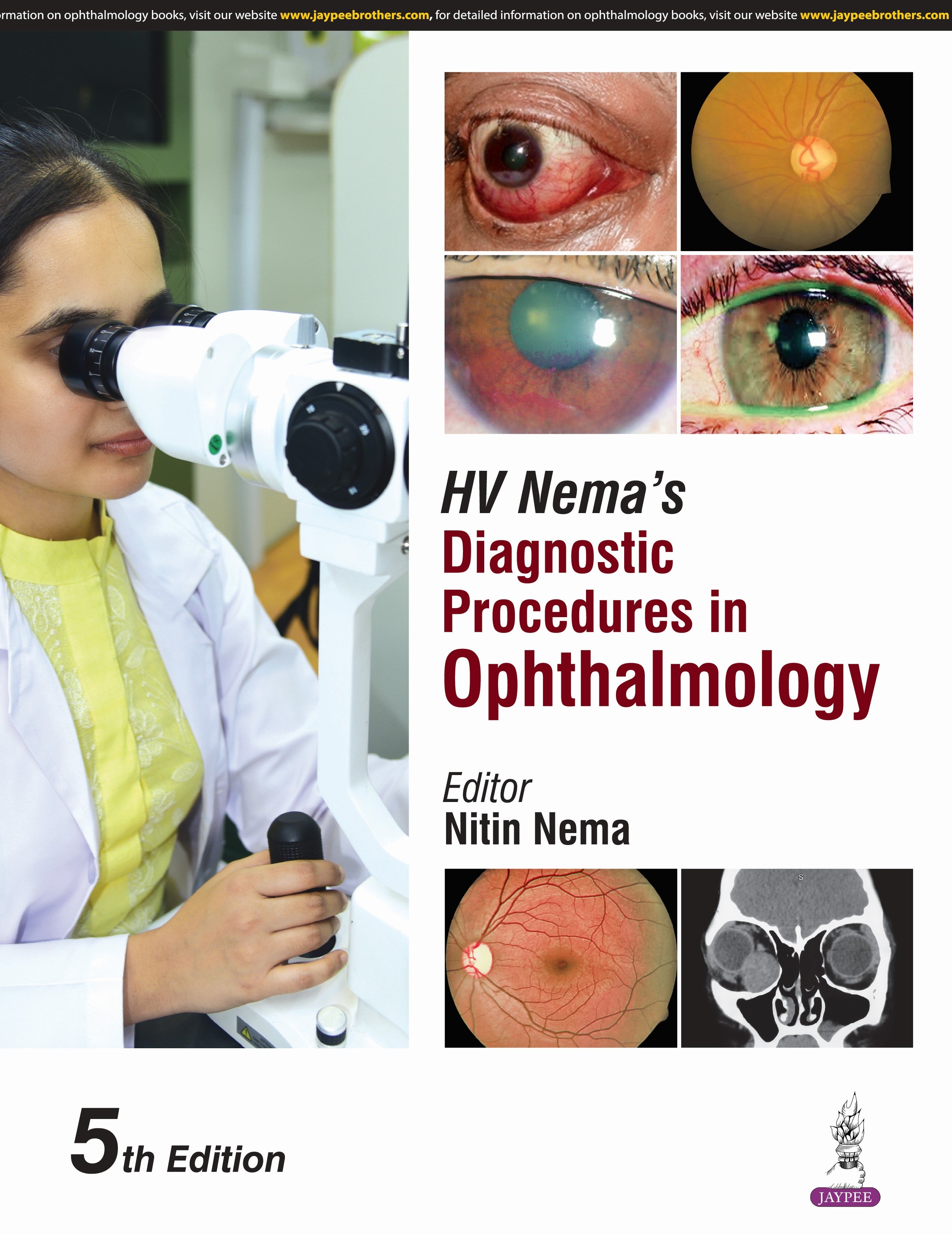 HV NEMA'S DIAGNOSTIC PROCEDURES IN OPHTHALMOLOGY