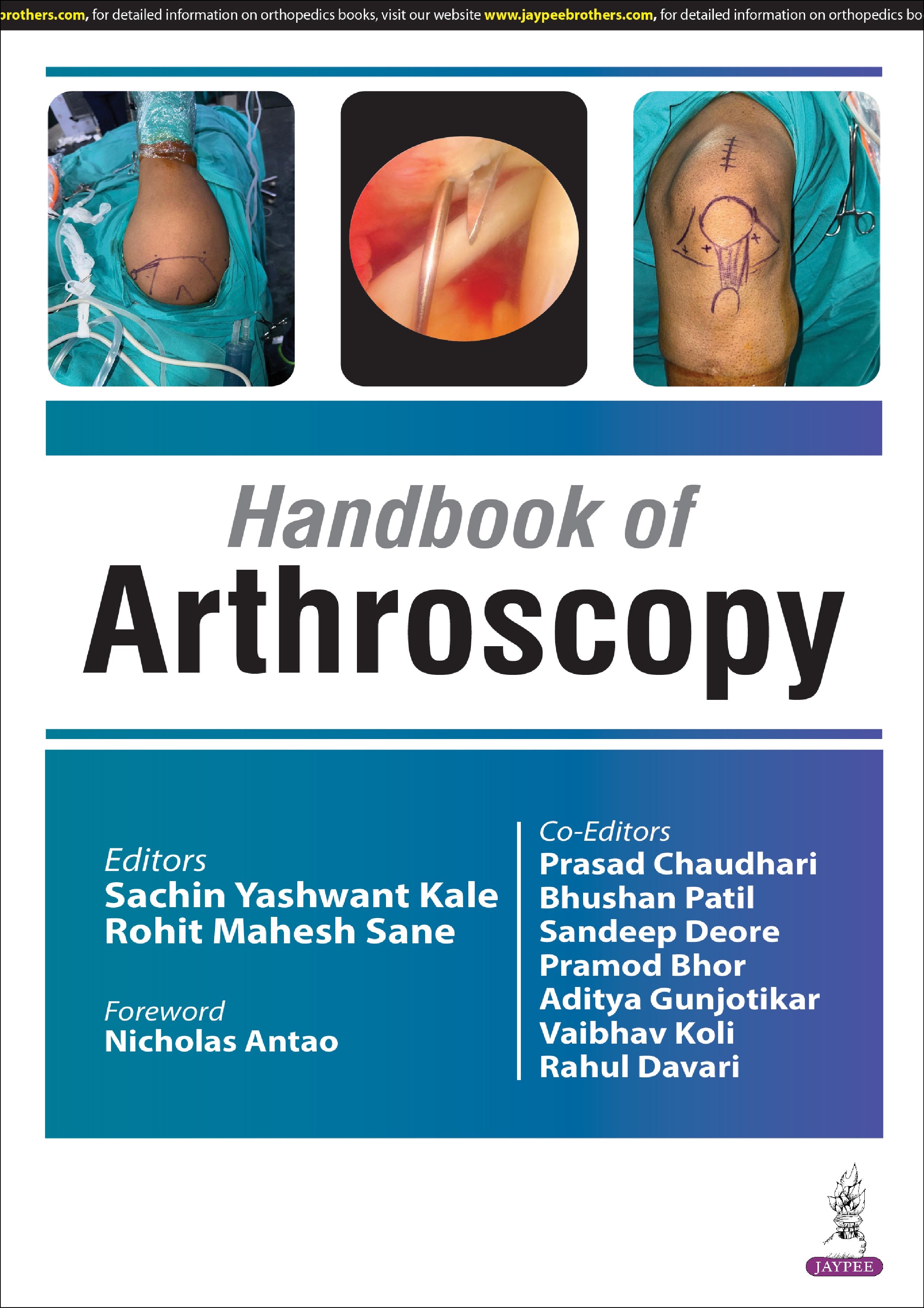 HANDBOOK OF ARTHOSCOPY