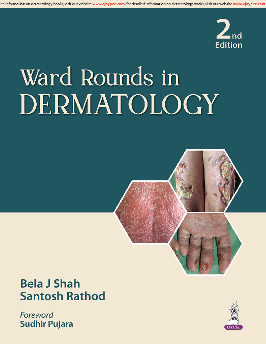 Ward Rounds in Dermatology