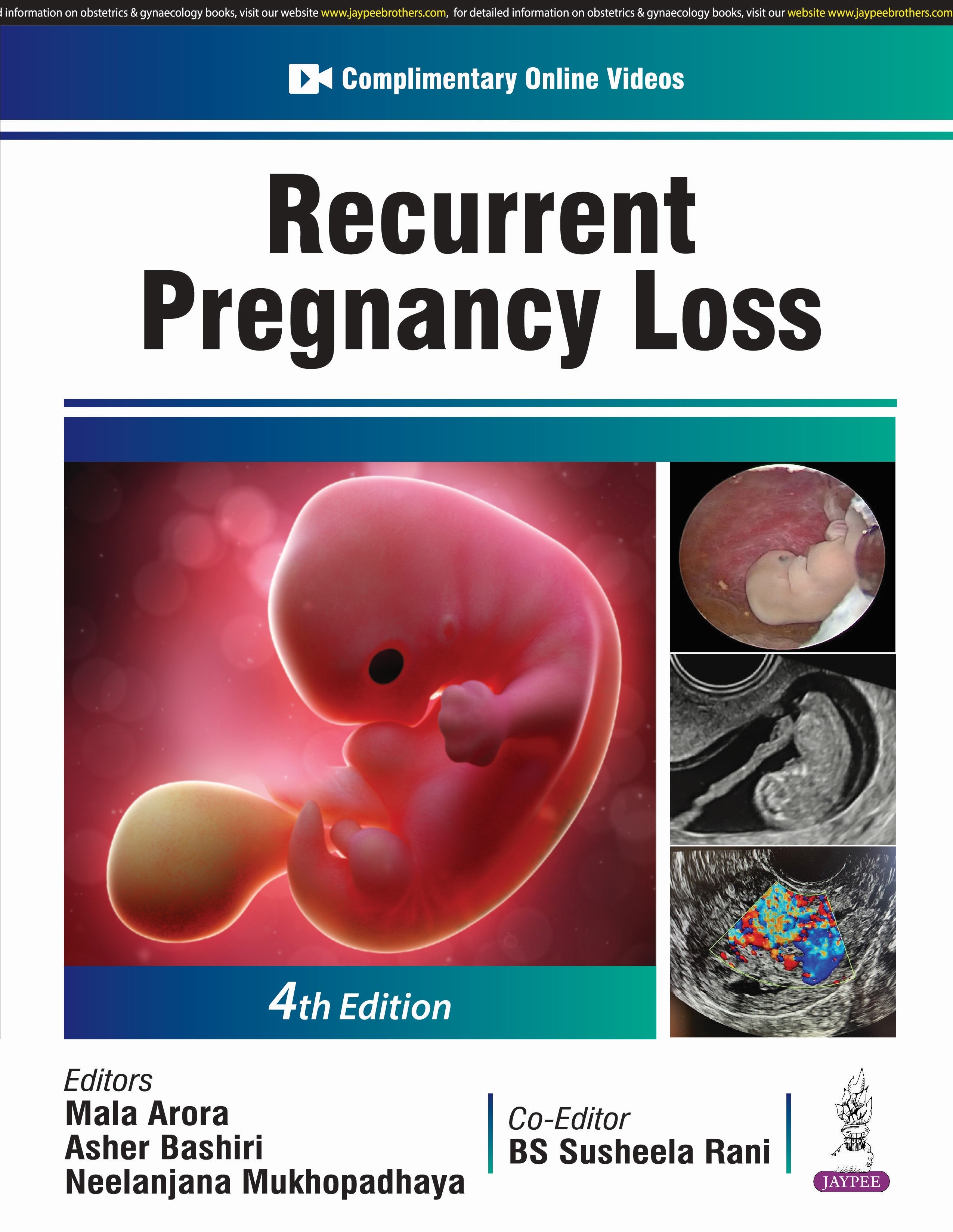 RECURRENT PREGNANCY LOSS