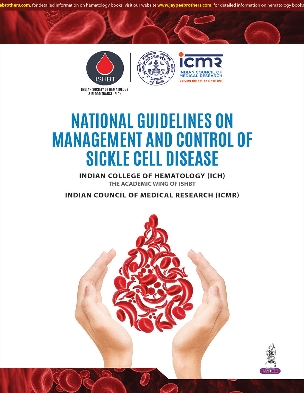 NATIONAL GUIDELINES ON MANAGEMENT AND CONTROL OF SICKLE CELL DISEASE