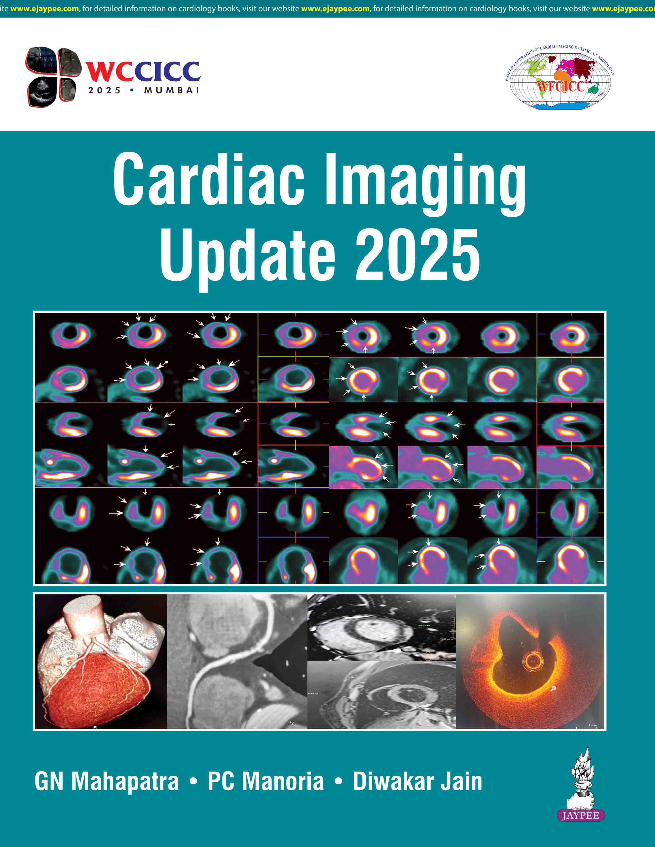 Cardiac Imaging Update 2025