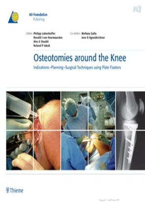 OSTEOTOMIES AROUND THE KNEE(Indian reprint)