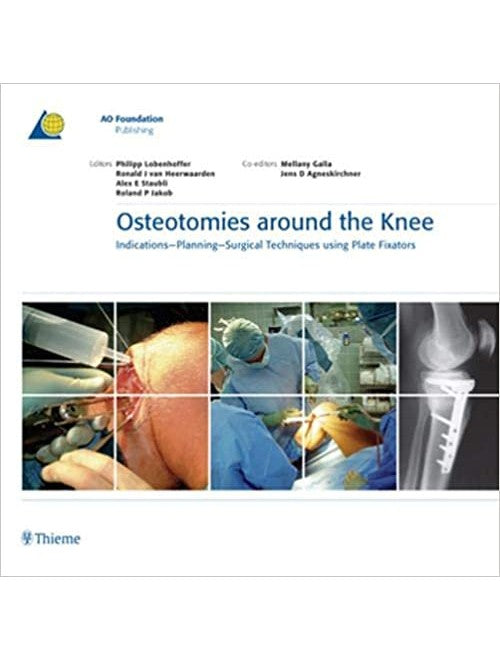 OSTEOTOMIES AROUND THE KNEE