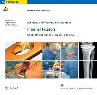 AO MANUAL OF FRACTURE MANAGEMENT INTERNAL FIXATORS