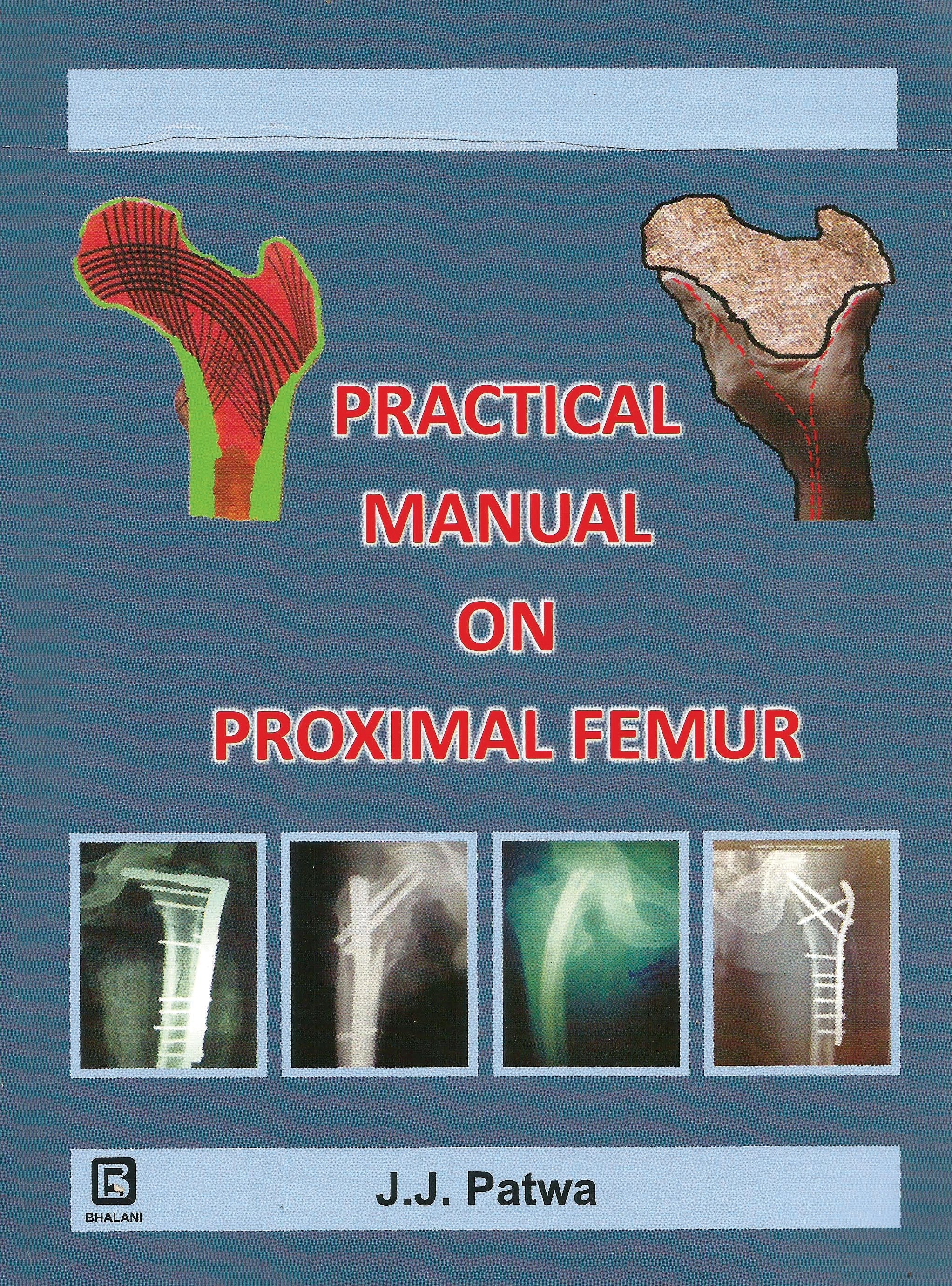 Practical Manual On Proximal Femur