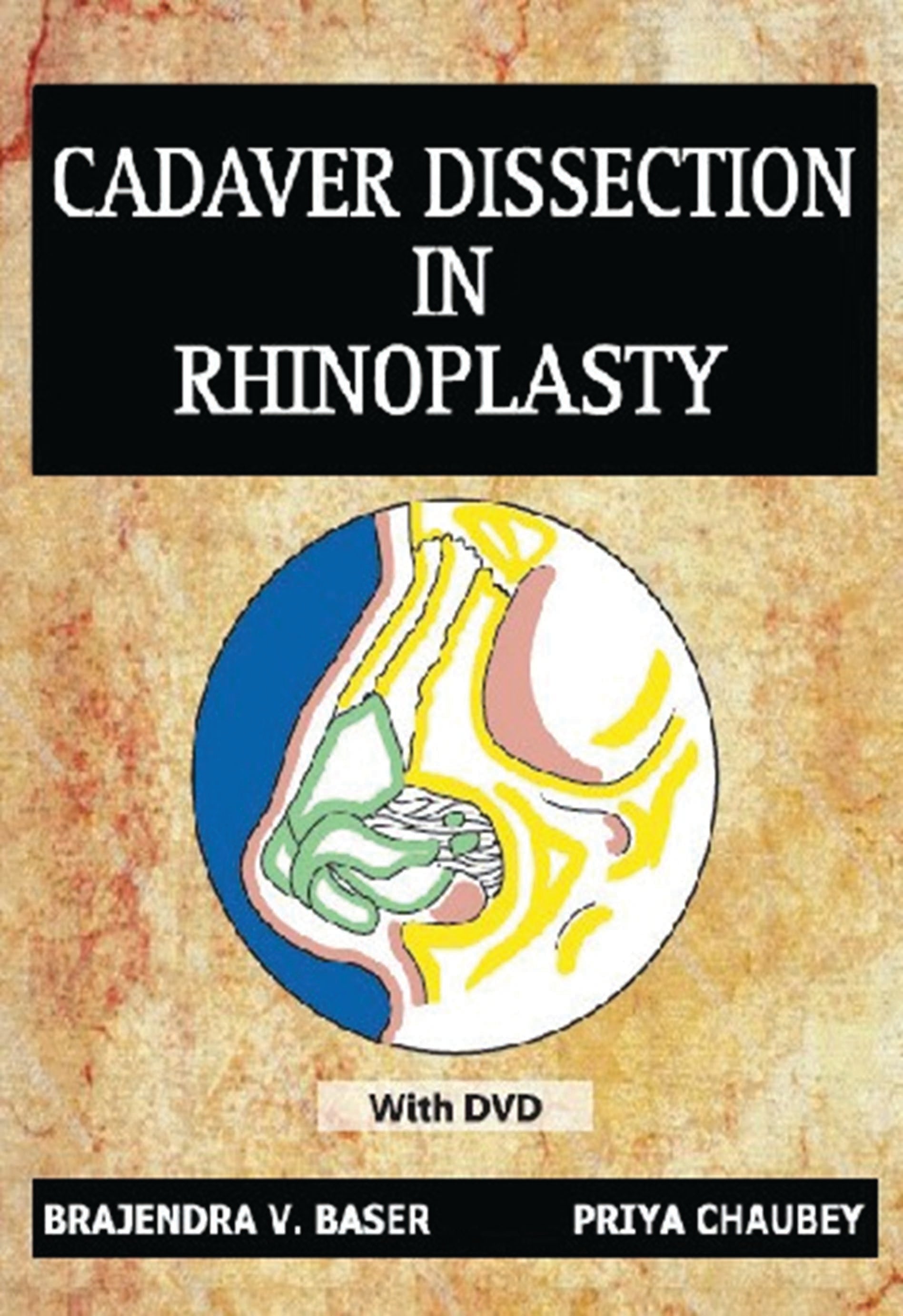 Manual Of Cadaver Dissection In Rhinoplasty With Dvd