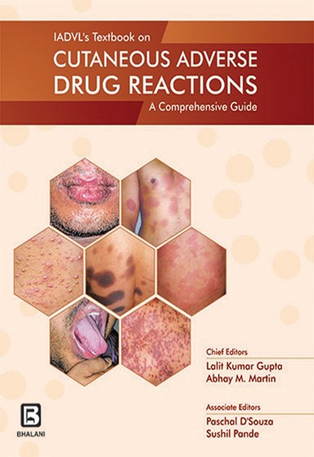 IADVL’S Textbook On Cutaneous Adverse Drug Reaction: A Comprehensive Guide