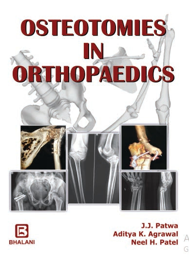 Osteotomies In Orthopaedics