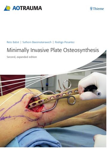 Minimally Invasive Plate Osteosyntheis (HB)