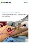 Minimally Invasive Plate Osteosyntheis (HB)