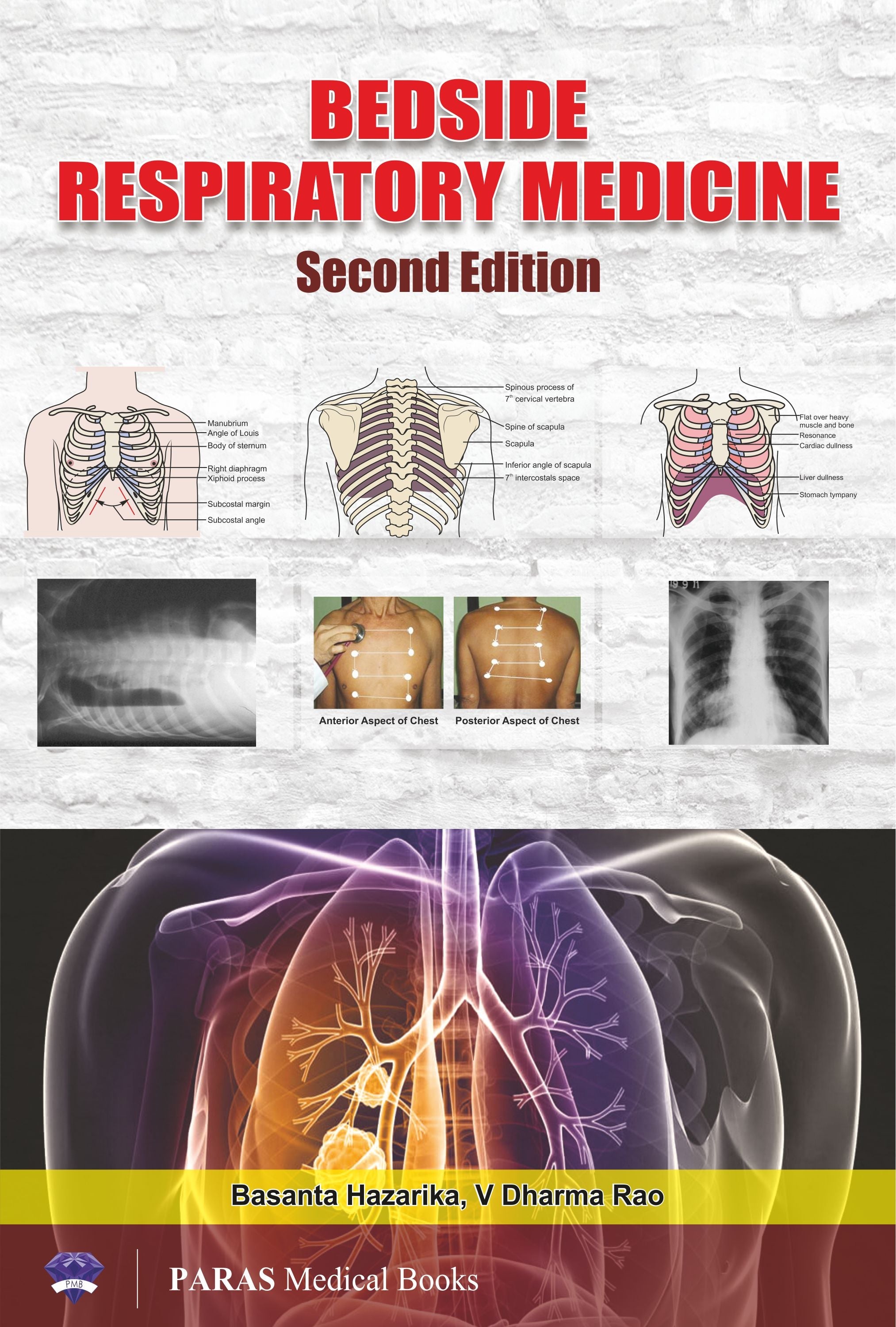 Bedside Respiratory Medicine