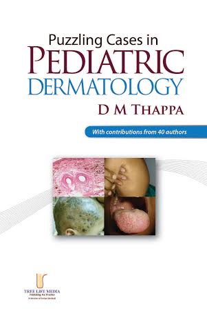 Puzzling Cases in Pediatric Dermatology Volume 1