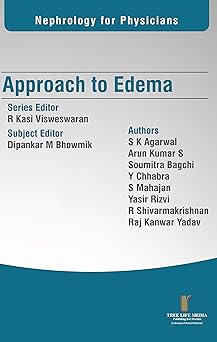 Nephrology for Physicians  Approach to Edema