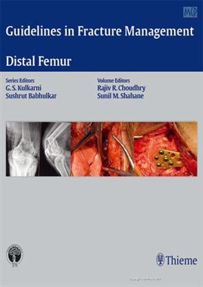 Guidelines in Fracture Management - Distal Femur