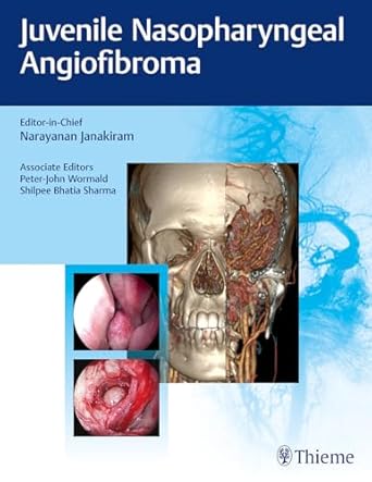 Juvenile Nasopharyngeal Angiofibroma 1st Edition