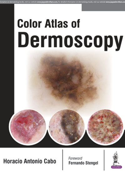 COLOR ATLAS OF DERMOSCOPY