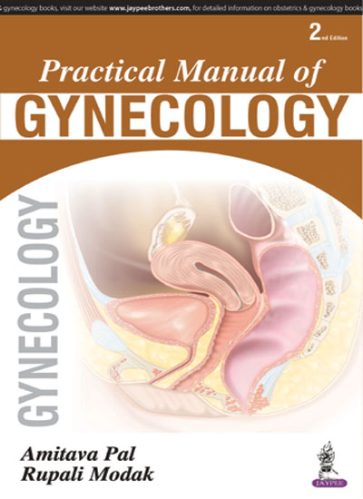 PRACTICAL MANUAL OF GYNECOLOGY