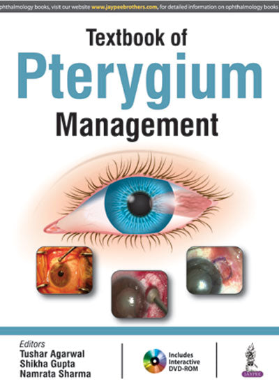 TEXTBOOK OF PTERYGIUM MANAGEMENT WITH DVD-ROM