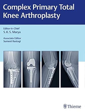 Complex Primary Total Knee Arthroplasty