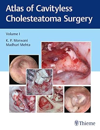 Atlas of Cavityless Cholesteatoma Surgery (Volume 1)