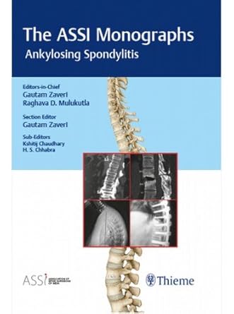 The ASSI Monographs-Ankylosing Spondylitis