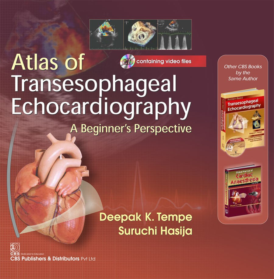 Atals of Transesophageal Echocardiography A Beginners Perspective (Included CD Containing Video Files)  (HB)