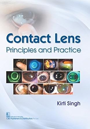 Contact Lens: Principles and Practice (PB)