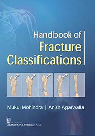 Handbook of Fracture Classifications (PB)