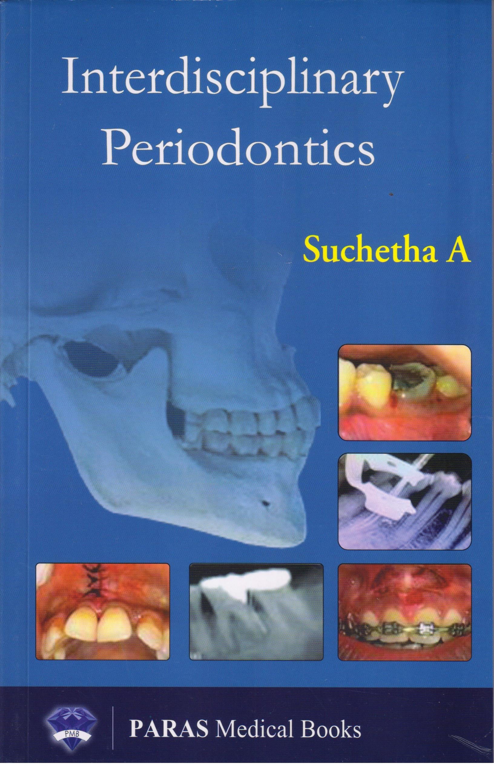 Interdisciplinary Periodontics