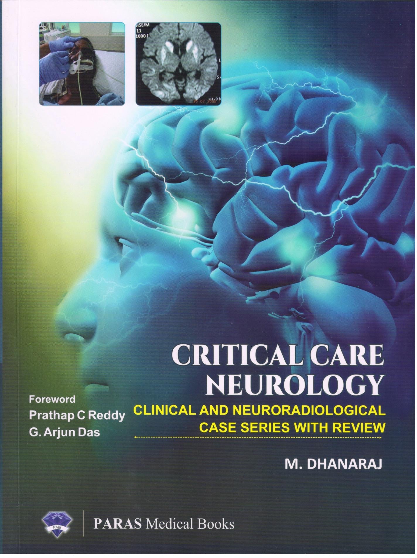 Critical Care Neurology (Clinical and Neuroradiological Case Series)