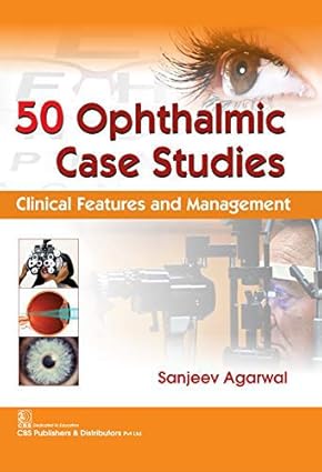 50 Ophthalmic Case Studies: Clinical Features and Management (PB)