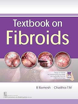 Textbook on Fibroids (PB)