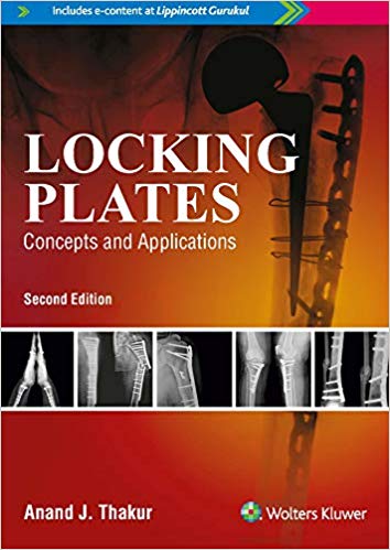 Locking Plates Concepts and Applications