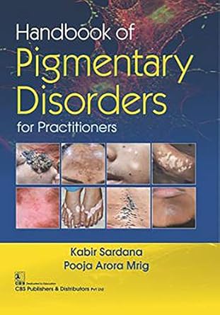 Handbook of Pigmentary Disorders for Practitioners (HB)