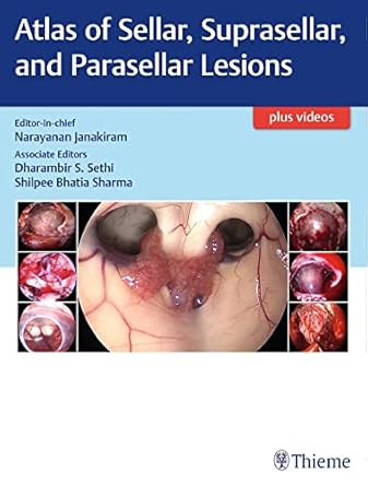 Atlas of Sellar, Suprasellar, and Parasellar Lesions