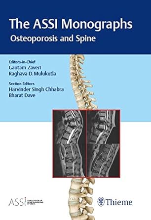 The ASSI Monographs - Osteoporosis and Spine