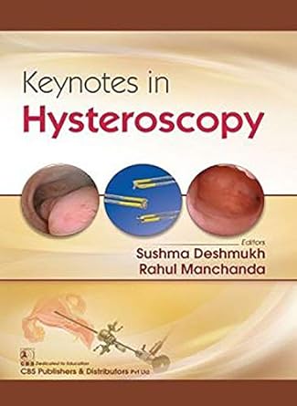 Keynotes in Hysteroscopy (PB)