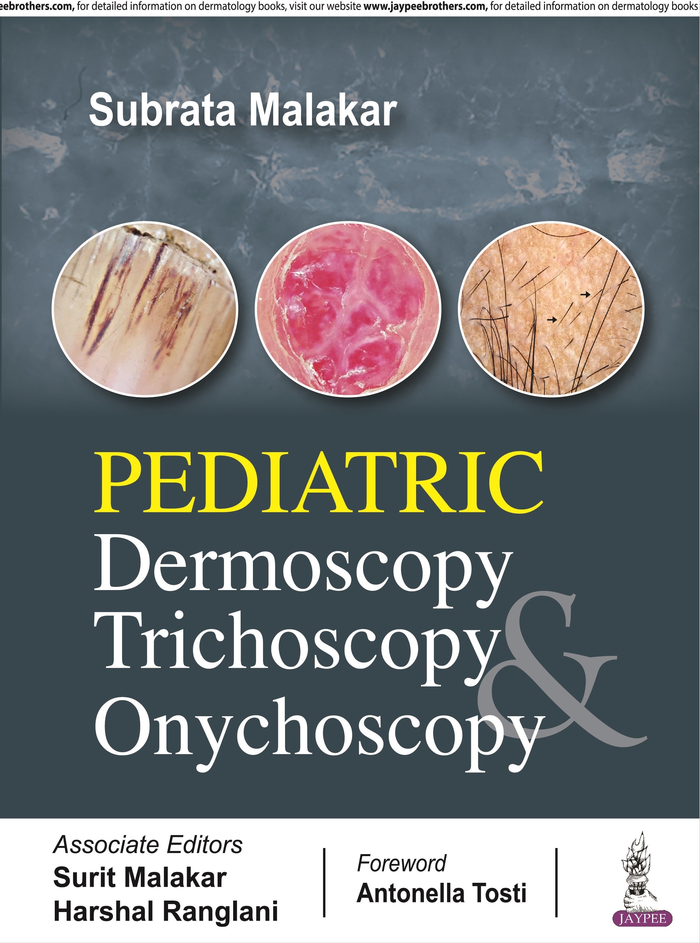 PEDIATRIC DERMOSCOPY, TRICHOSCOPY & ONYCHOSCOPY