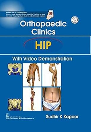 Orthopaedic Clinics HIP with Video Demonstration (HB)